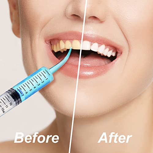 Zhengmy 100 Pack Dental Syringe with Curved Tip 12ml Disposable Irrigation Dental Syringe for Tonsil Stones Squirt Liquid Injection Mouthwash Cleaner Oral Tooth Care(with Capacity Scale) - style: With Capacity Scale