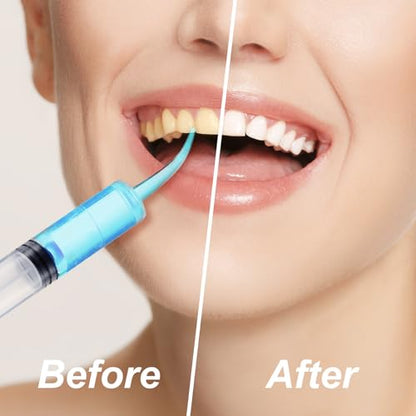 Zhengmy 100 Pack Dental Syringe with Curved Tip 12ml Disposable Irrigation Dental Syringe for Tonsil Stones Squirt Liquid Injection Mouthwash Cleaner Oral Tooth Care (Without Capacity Scale) - style: Without Capacity Scale